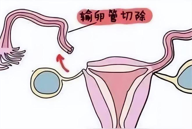 苏州同济不孕不育